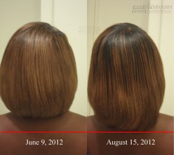 5 Mẹo giúp tóc mọc nhanh