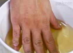 Trị đau khớp ư, dễ như trở bàn tay!