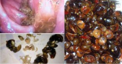 Sai lầm chết người khi ăn ốc mà ai cũng mắc phải