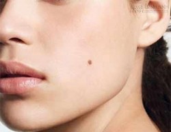 Nữ giới kỵ nốt ruồi ở vị trí nào?