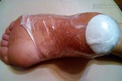Quấn theo cách này, bạn sẽ không bao giờ bị nứt gót chân nữa
