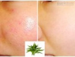 3 loại rau quen thuộc giúp thu nhỏ lỗ chân lông siêu tốc