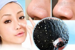 Trị tận gốc mụn đầu đen chỉ với 4 bước đơn giản mỗi ngày