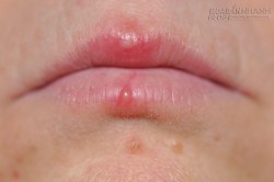 10 Hậu quả ghê rợn của việc cắn móng tay ít ai ngờ tới