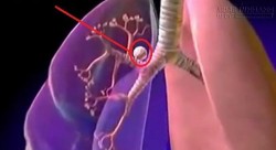 Bi kịch có thật ở Việt Nam: Vợ ung thư, chồng không dám gieo mạ