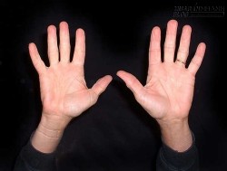 Khoảng cách giữa các ngón tay hé lộ tính cách bạn