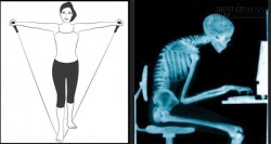 2 phút làm 1 động tác này, hiệu quả gấp 100 lần thuốc trị đau vai gáy