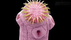 Suýt chết vì sán dây… làm ổ trong não