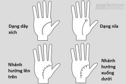 Các dạng đường sinh mệnh thường gặp và ý nghĩa của chúng