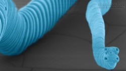 Phát hiện cực sốc về mối liên hệ giữa sán dây và bệnh ung thư