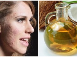 Bí quyết uống và mát xa để trị da sần sùi ngay tại nhà