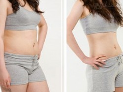 Giảm 5cm vòng eo trong 1 tuần nhờ 4 loại rau củ quen thuộc