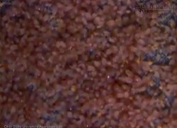 Khủng khiếp: bạn ngủ với 10 triệu con này mỗi đêm mà không hề biết