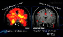 Ăn nhiều đường hại não của chúng ta như thế nào?