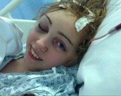 Sốc: Cô gái sống chung với khối u não 6 năm không hề hay biết