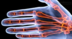 Nguy hại khôn lường khi bẻ khớp ngón tay có thể bạn chưa biết