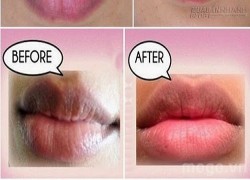 10 phút hô biến môi thâm xì thành hồng hào tự nhiên