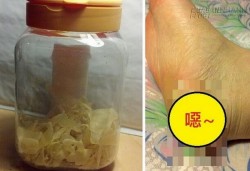 Kinh hãi với sản phẩm da chân thiếu nữ được rao bán với giá trên trời