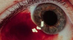 Hoảng hồn căn bệnh khiến mắt bỗng dưng chảy máu