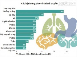 Khả năng di truyền của 12 loại ung thư