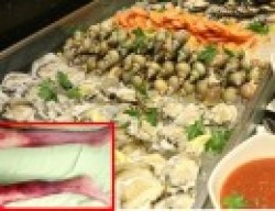 Kinh hoàng với đôi chân biến dạng lở loét chỉ vì ăn… hải sản sống