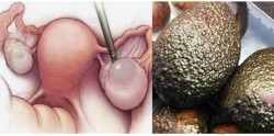 Nói không với ung thư tử cung khi ăn cái này trong ngày đèn đỏ