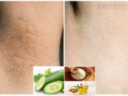 Hỗn hợp trị thâm nách tuyệt vời trên cả mong đợi mà chưa đến 5 nghìn đồng