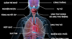 20 Điều kinh khủng sẽ xảy ra khi bạn uống thêm một chén rượu