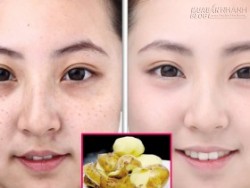 Công dụng làm đẹp không thể tưởng của những thứ thường vứt đi khi ăn