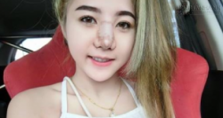 Tròn mắt với màn tự phẫu thuật nâng mũi của cô nàng xinh đẹp