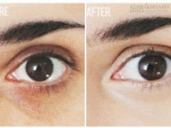 Xóa tan bọng mắt, quầng thâm trong 5 phút với nguyên liệu chưa đến 2k
