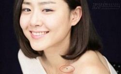 Nốt ruồi mọc ở những vị trí này có thể mang điềm gở cho bạn