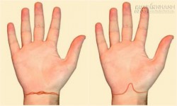 Nhìn ngấn cổ tay đoán số phận, sức khỏe của bạn
