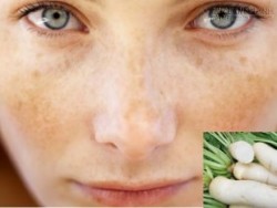 Loại củ quả quen thuộc mà bạn không nghĩ sẽ trị được nám