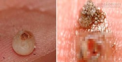 Sinh vật cứ ngỡ chỉ có trên chó mèo này hoàn toàn có thể làm tổ trên con người