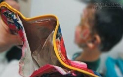 Cảnh báo nguy hiểm khôn lường từ việc sử dụng túi sưởi cho trẻ