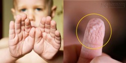 Vì sao da tay bạn thường nhăn sau khi tắm?