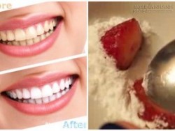 Chỉ cần chà thứ này là răng trắng sáng, nụ cười tỏa nắng đón Tết thêm xinh