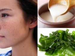 Học người Hàn cách trị nám da vừa nhanh vừa hiệu quả