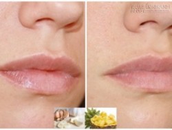 Tuyệt chiêu tẩy nốt ruồi tại nhà an toàn chỉ trong 5 ngày