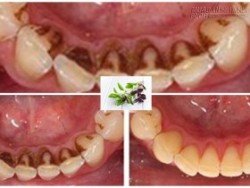 Giật mình với loại rau chưa đến 2k đánh sạch mảng bám, ố vàng trong 1 nốt nhạc