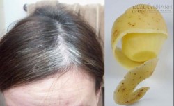 Vỏ khoai tây: chữa tóc bạc sớm không cần thuốc nhuộm hiệu quả 100%