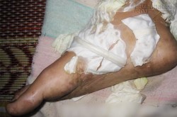 Khả năng chữa lành vết thương kì diệu đến từ loại rau ai cũng biết