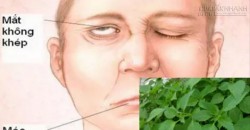 Cách cấp cứu kịp thời người bị trúng gió trước khi quá muộn