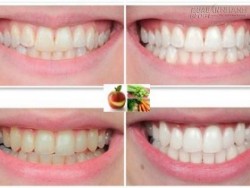 4 cách giúp răng miệng luôn sáng bóng và thơm mát bạn nên bỏ túi ngay