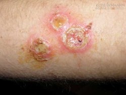 Khó ngờ trò chơi quen thuộc của trẻ nhỏ lại gây ra hậu quả thảm thương