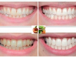 4 cách giúp răng miệng luôn sáng bóng và thơm mát bạn nên bỏ túi ngay