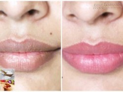 2 bước đơn giản biến môi thâm xì xấu xí thành sáng hồng tự nhiên