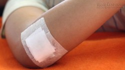 Lá trầu không – Thần dược cho sức khỏe