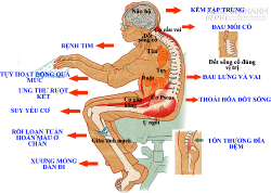 Cảnh báo những tác hại khôn lường của việc ngồi nhiều, ngồi quá lâu